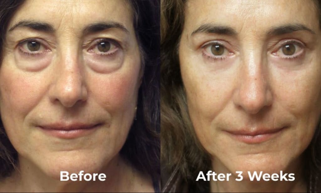 LumiEyes™ Glow Patches – Lifting & Éclat Instantané pour un Regard Jeune