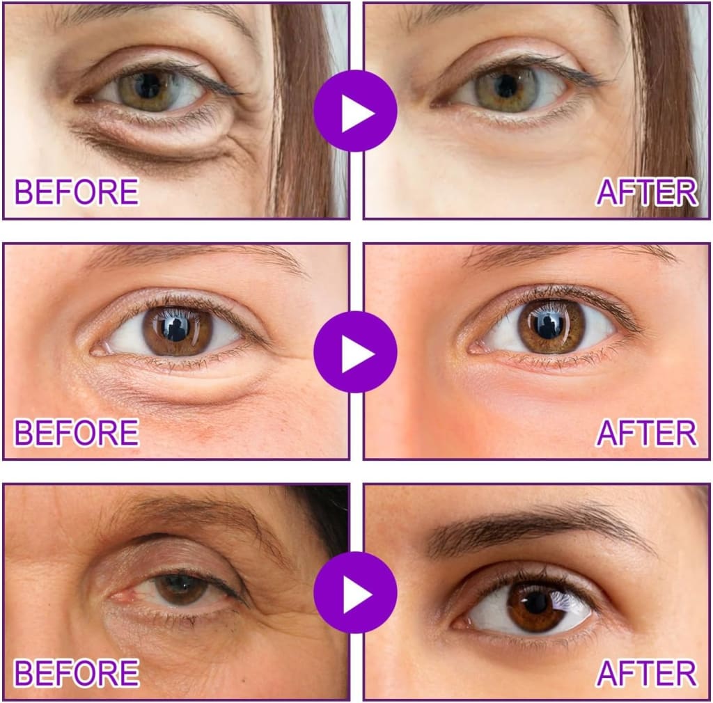 LumiEyes™ Glow Patches – Lifting & Éclat Instantané pour un Regard Jeune