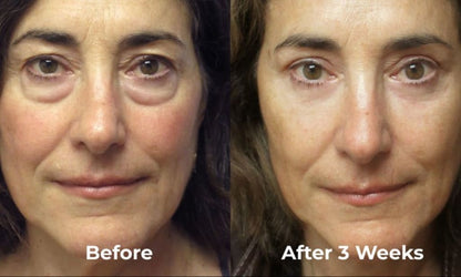 LumiEyes™ Glow Patches – Lifting & Éclat Instantané pour un Regard Jeune